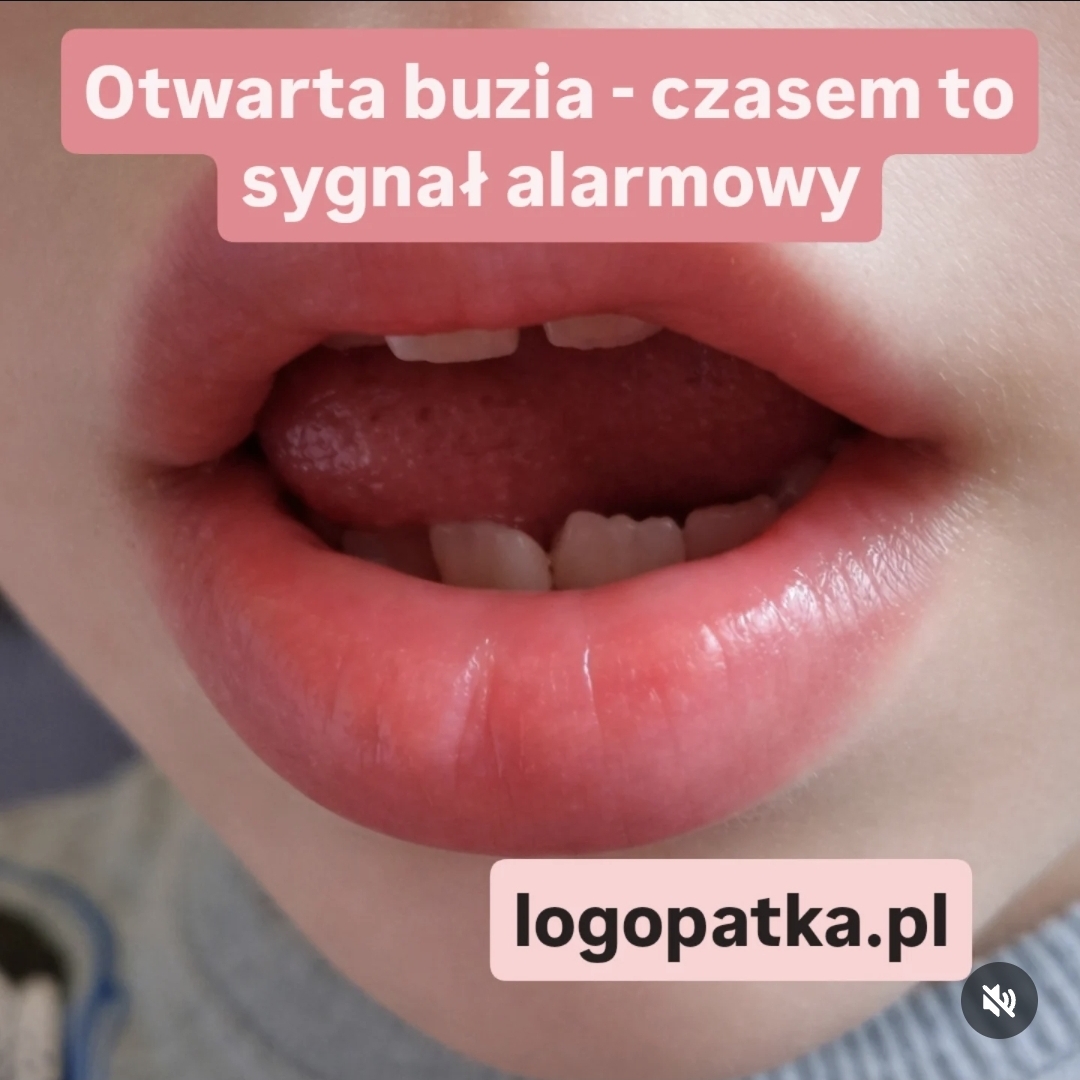 LogoPatka